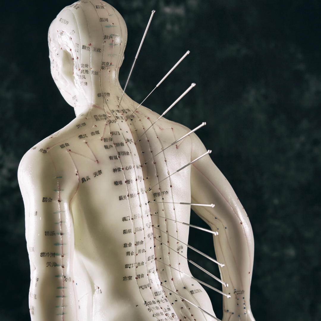 Acupuncture